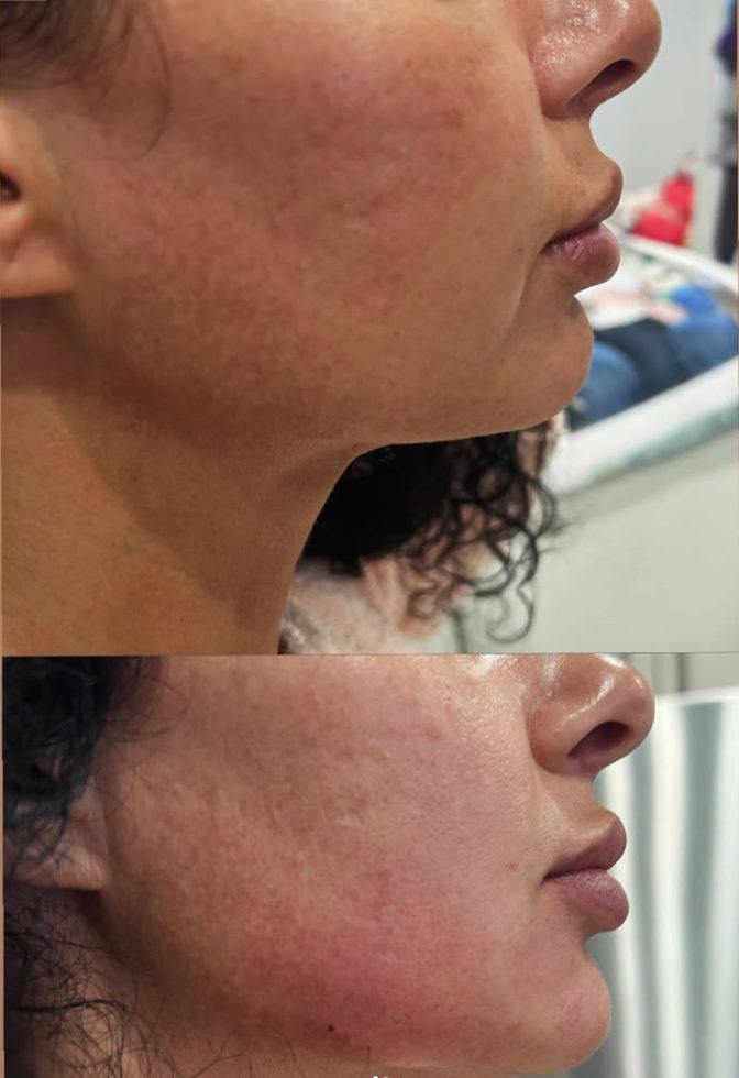 Before and after jaw definition