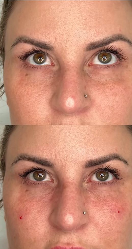 Before and after under-eye and skin