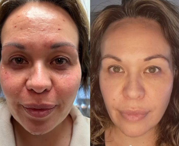 Skin clarity and glow result